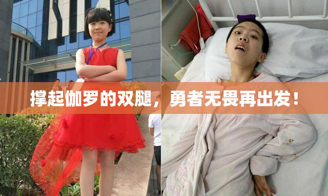 撑起伽罗的双腿，勇者无畏再出发！