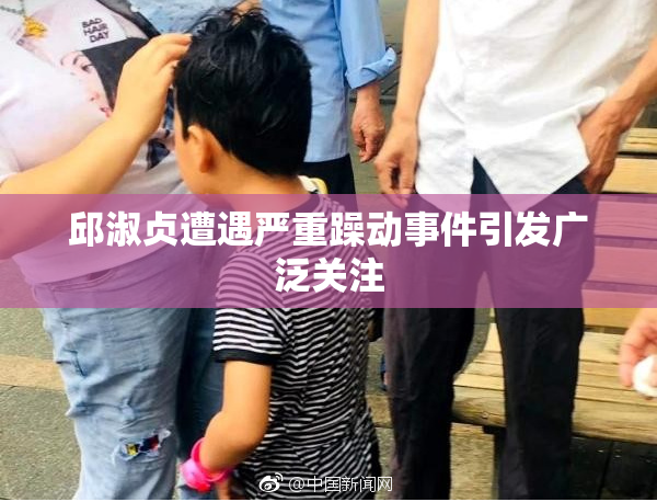邱淑贞遭遇严重躁动事件引发广泛关注