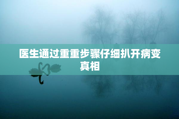 医生通过重重步骤仔细扒开病变真相