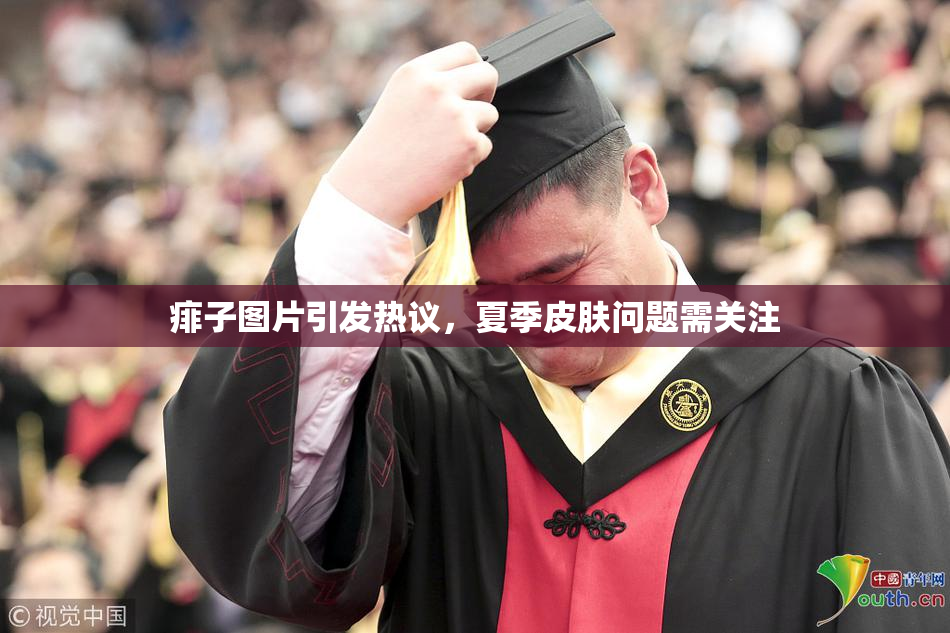 痱子图片引发热议，夏季皮肤问题需关注