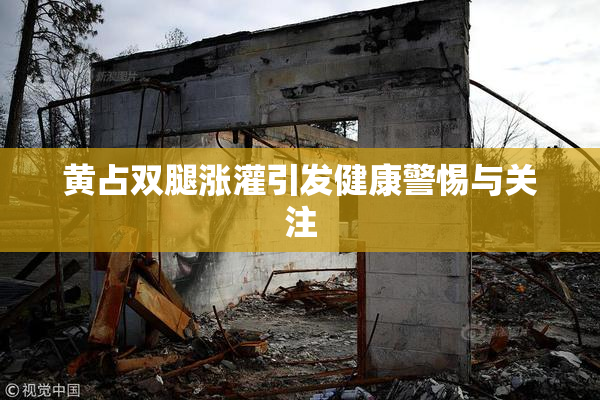 黄占双腿涨灌引发健康警惕与关注